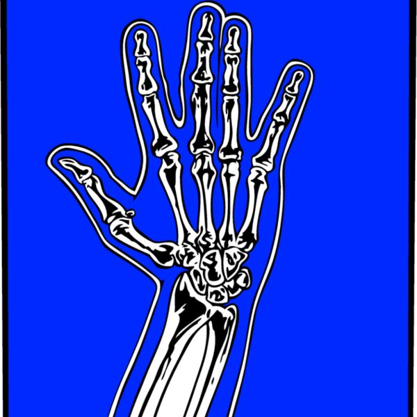 xrayM010 eps Thumbnail